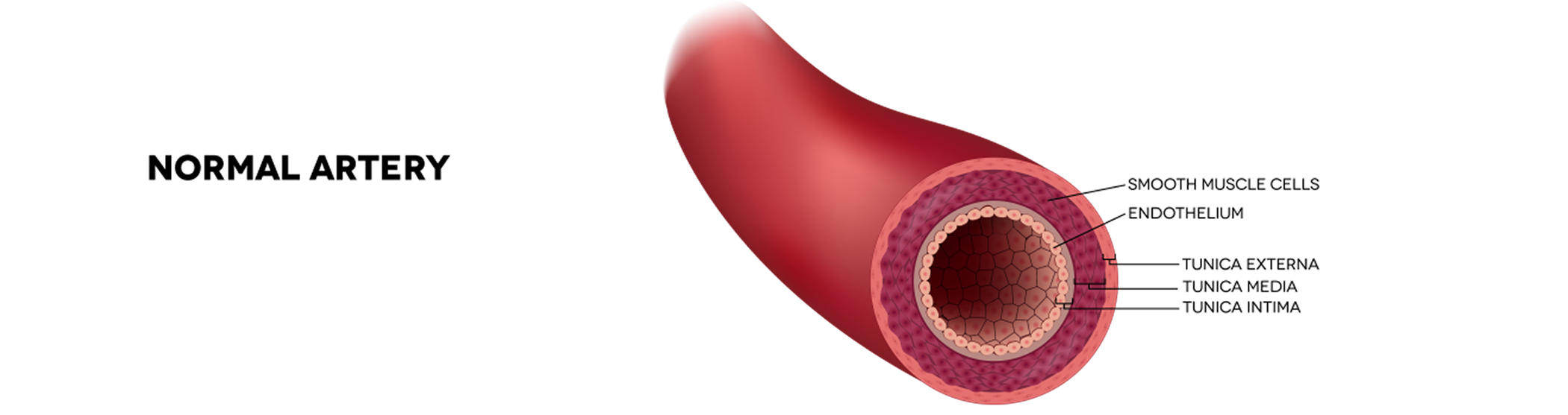 This illustration shows what a normal artery looks like.